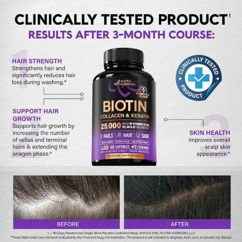 Biotin, Collagen, Hyaluronic Acid & Keratin - Hair Growth Support - 60 Caps