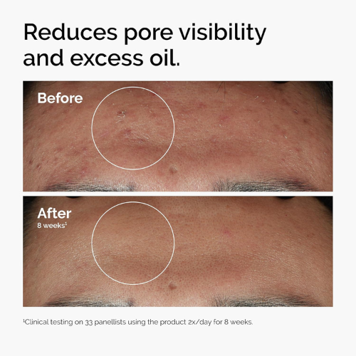 The Ordinary Niacinamide 10% + Zinc 1% | Oil Control & Pore Refining | 30ml
