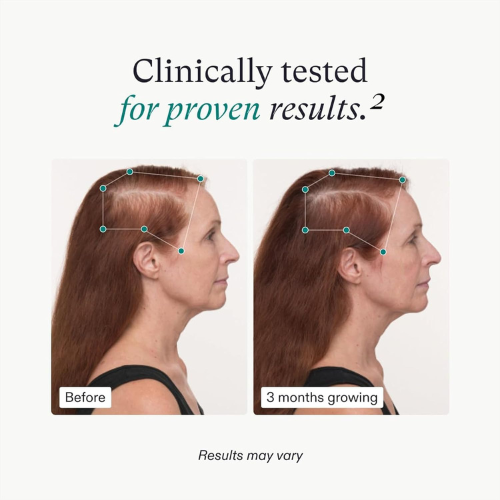 Nutrafol Women's Balance – Hair Growth Supplement for Ages 45+, 1-Month Supply